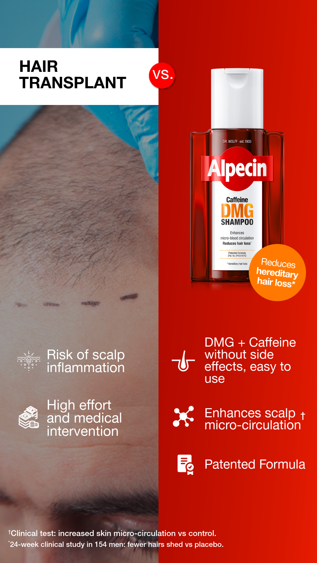 Alpecin Facebook ad