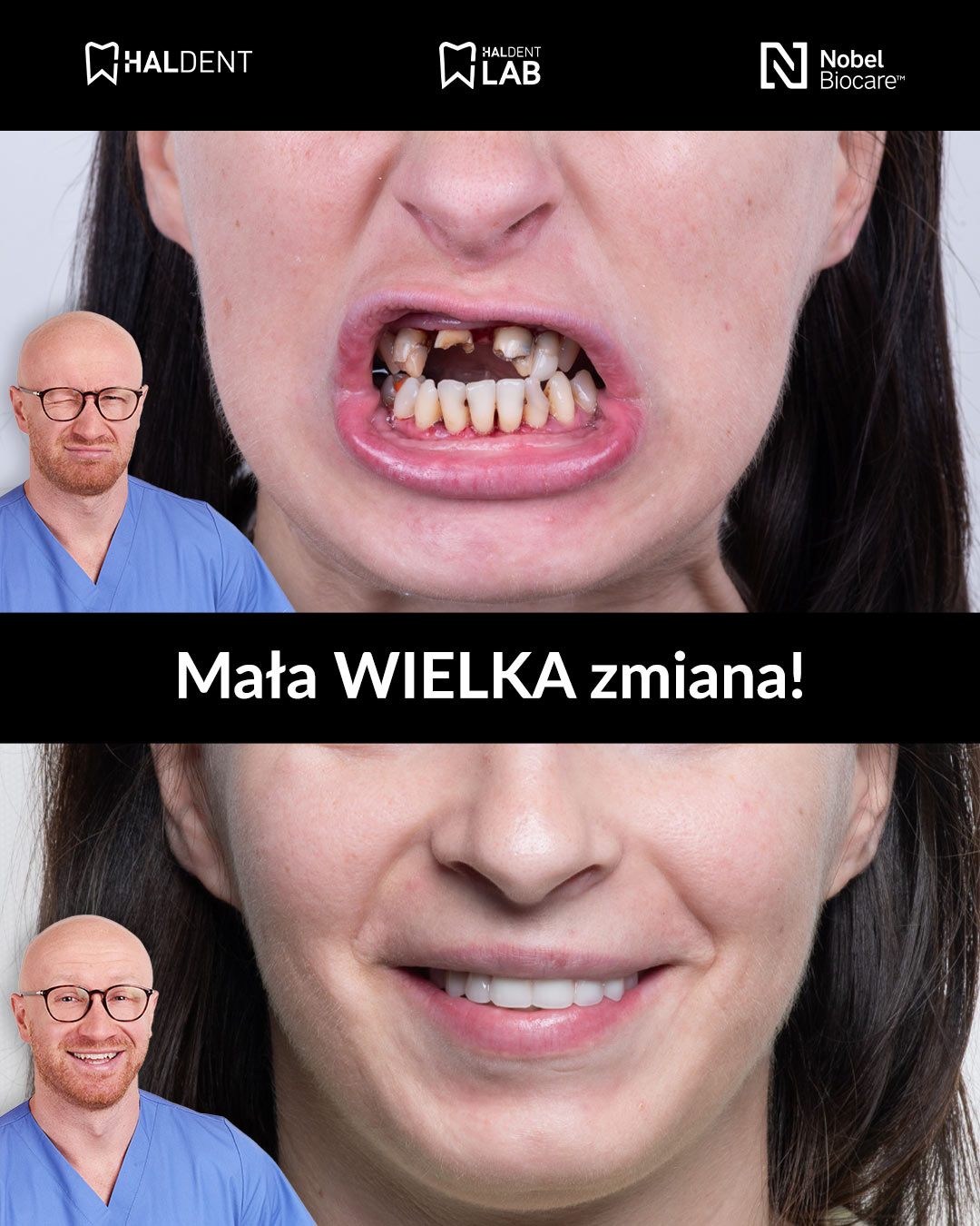 HALdent Facebook ad