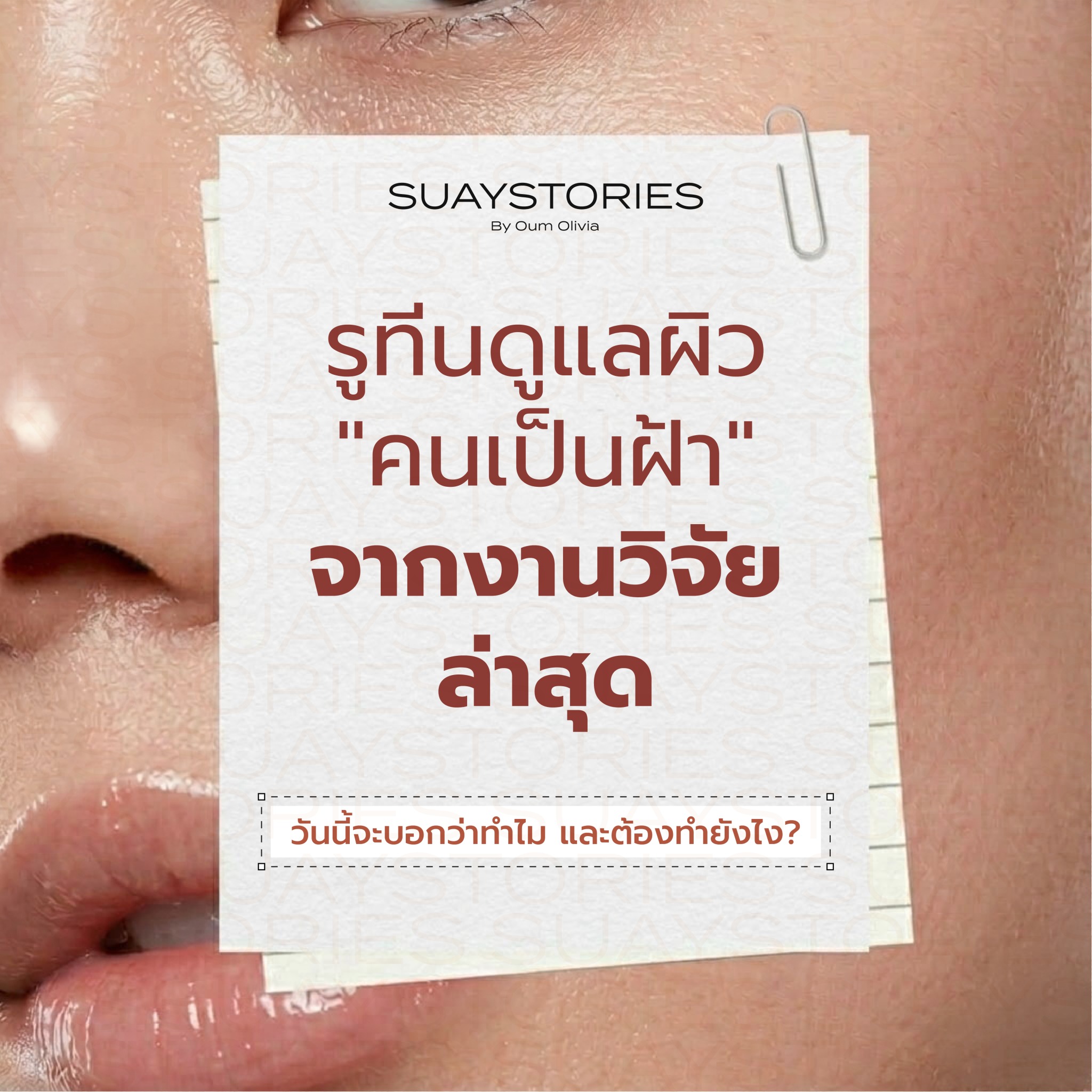 GURUCHECK เช็ค กับ กูรู Facebook ad: รูทีนดูแลผิว คนเป็นฝ้า