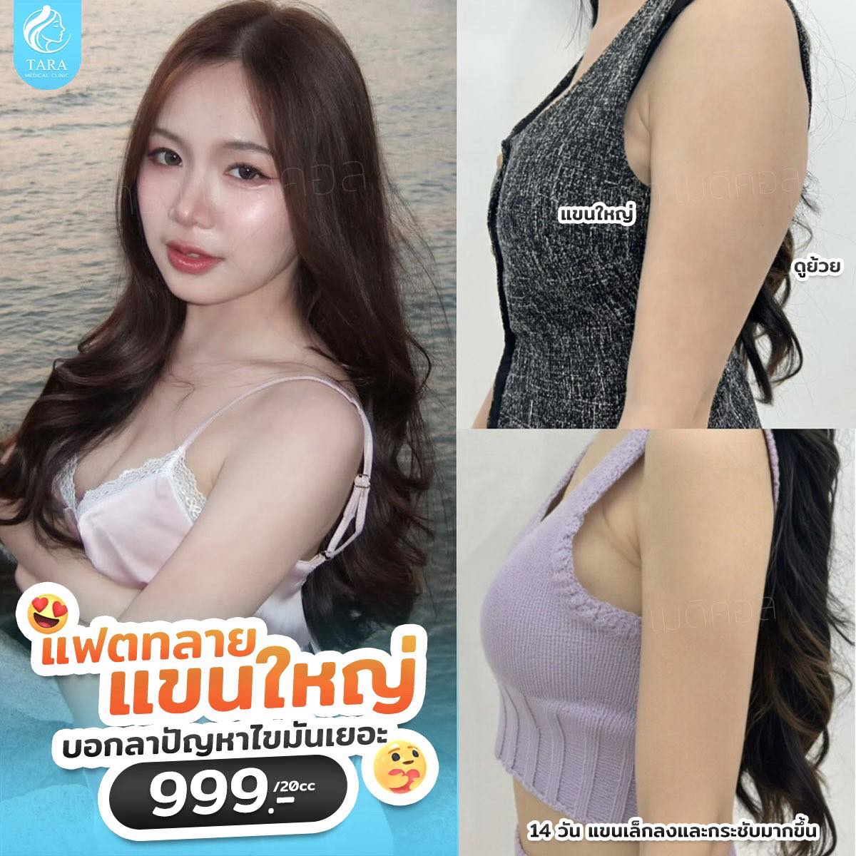 Tara Medical Clinic สาขาศรีราชา Facebook ad