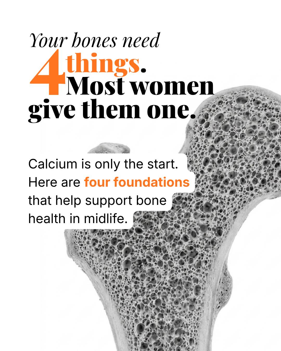 SecondSpring Facebook ad: If your entire bone plan is drink more…