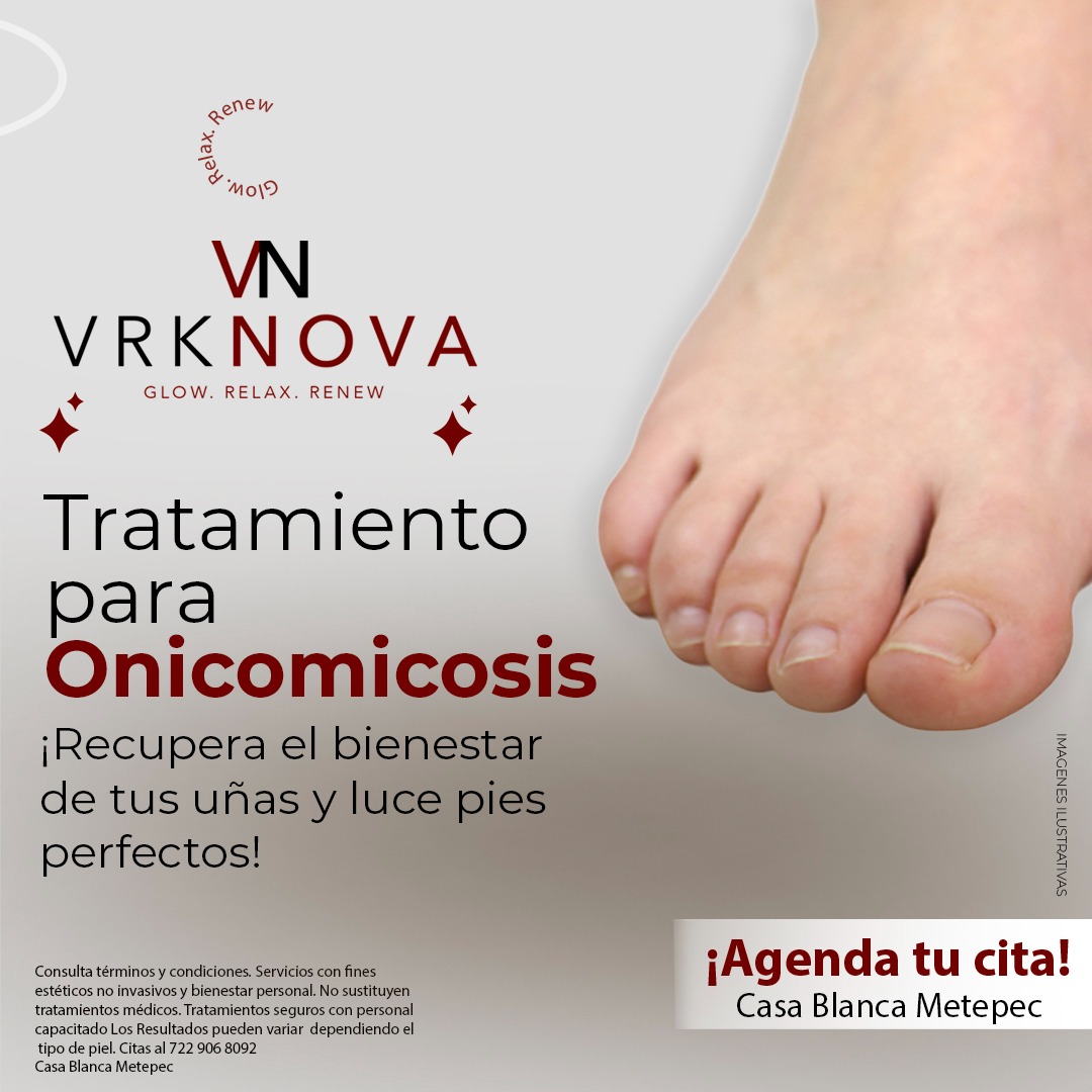 VRK NOVA Facebook ad: Agenda ahora