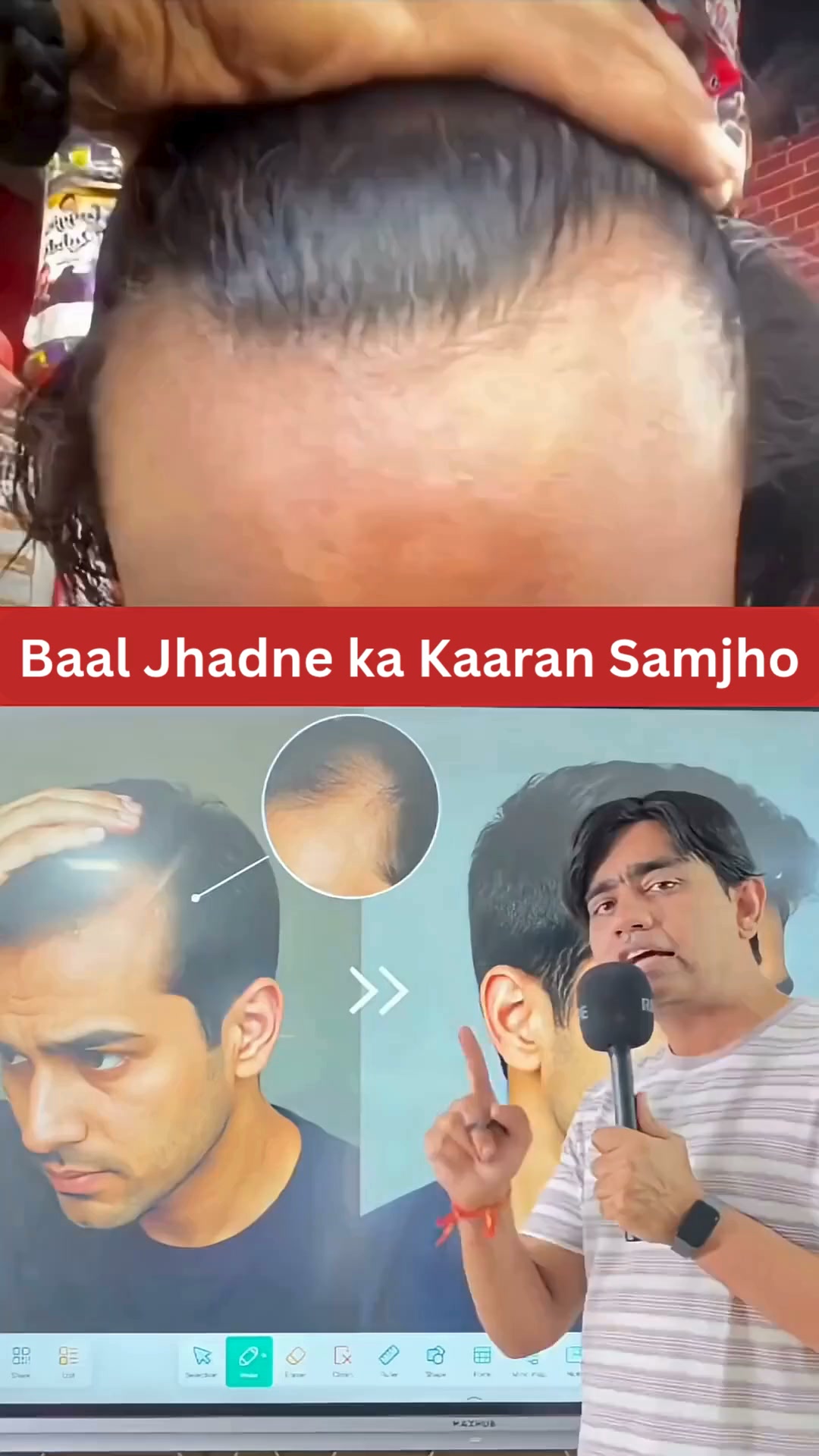 Hair Matters by Man Matters Facebook ad: No side effects | Clinically Tested