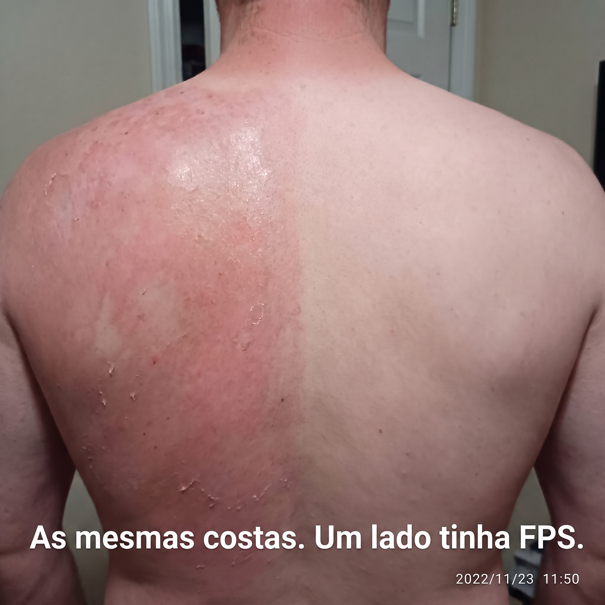 Cosméticos Orgânicos Familiares - InaEssentials.PT Facebook ad: As mesmas costas. Um lado estava protegido.