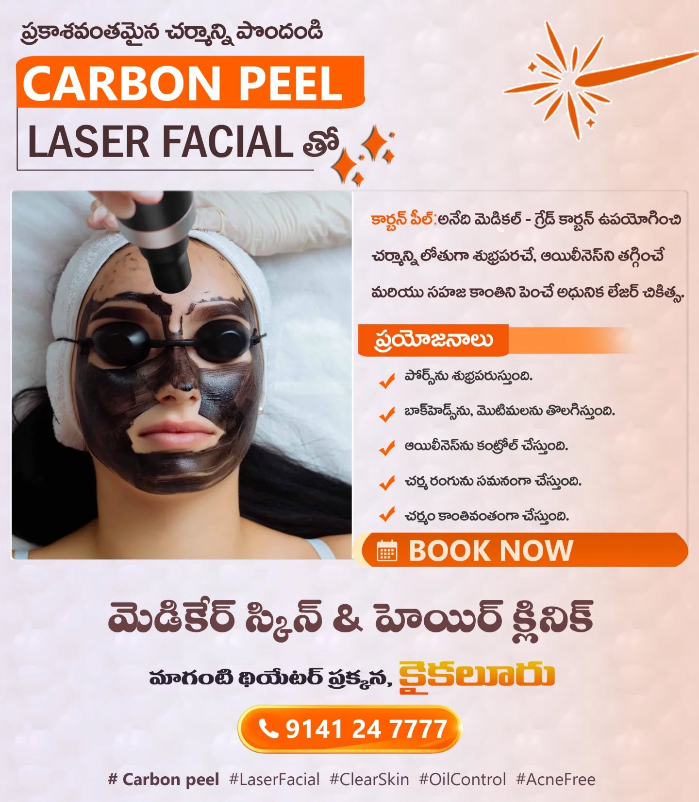 Medicare Skin and Hair Clinic Kaikalur Facebook ad: Carbon Peel Laser Facial