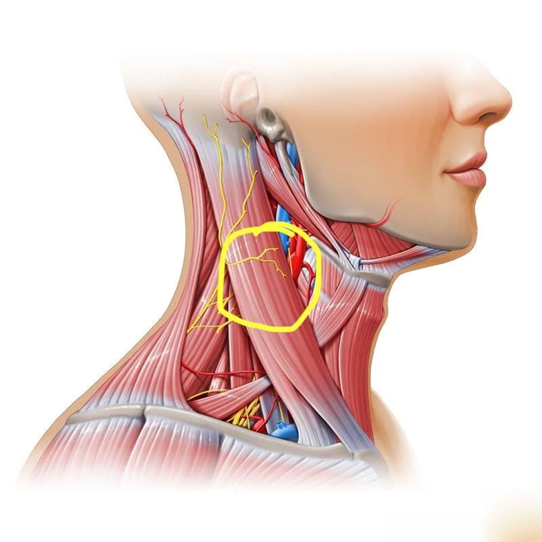 Susan Collins - The Neck & Shoulder Pain Community Facebook ad