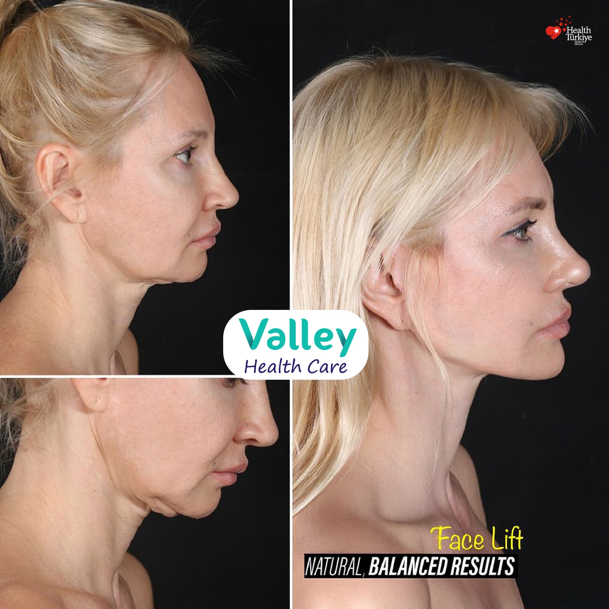 Valley Clinic Turkey Facebook ad