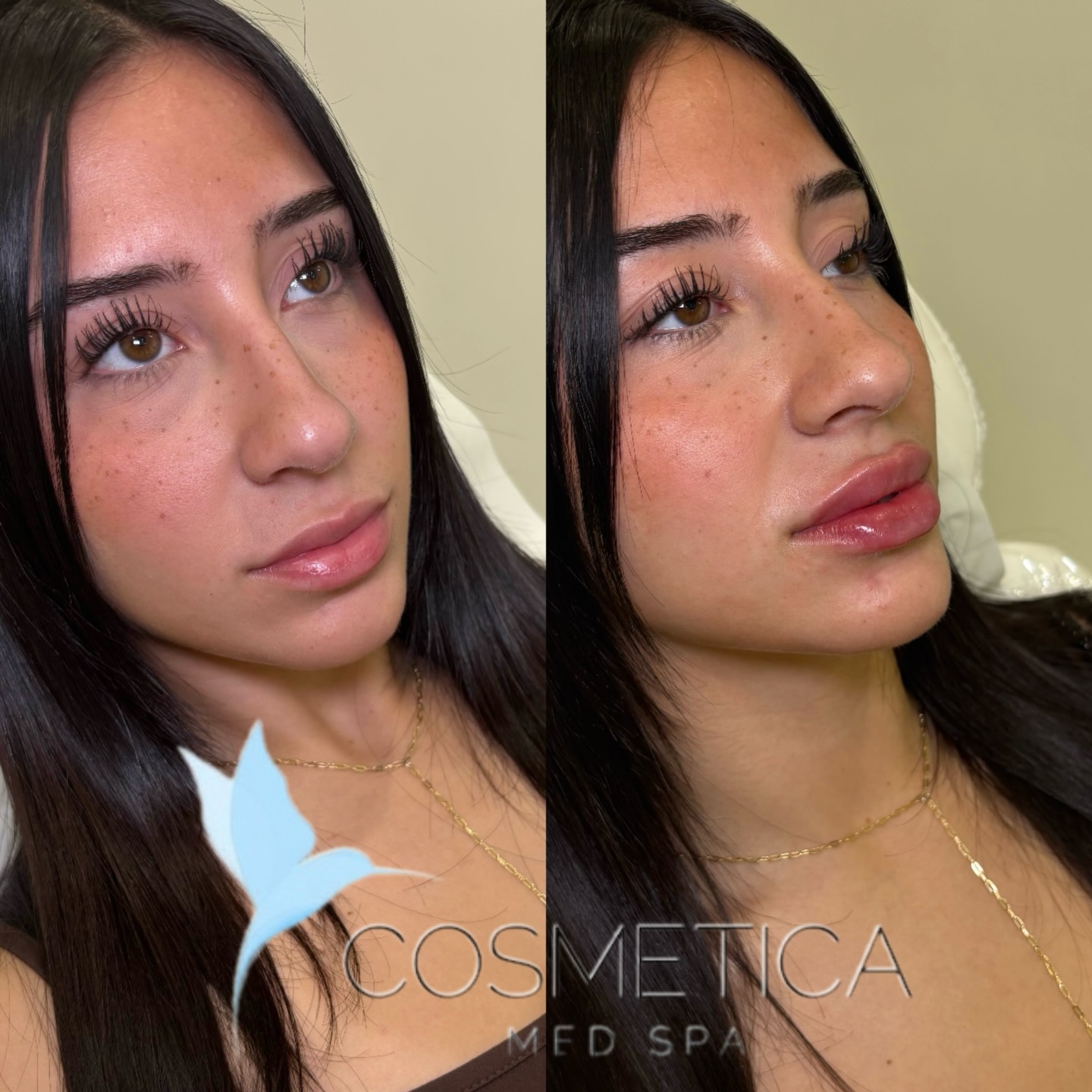 COSMETICA MED SPA Facebook ad