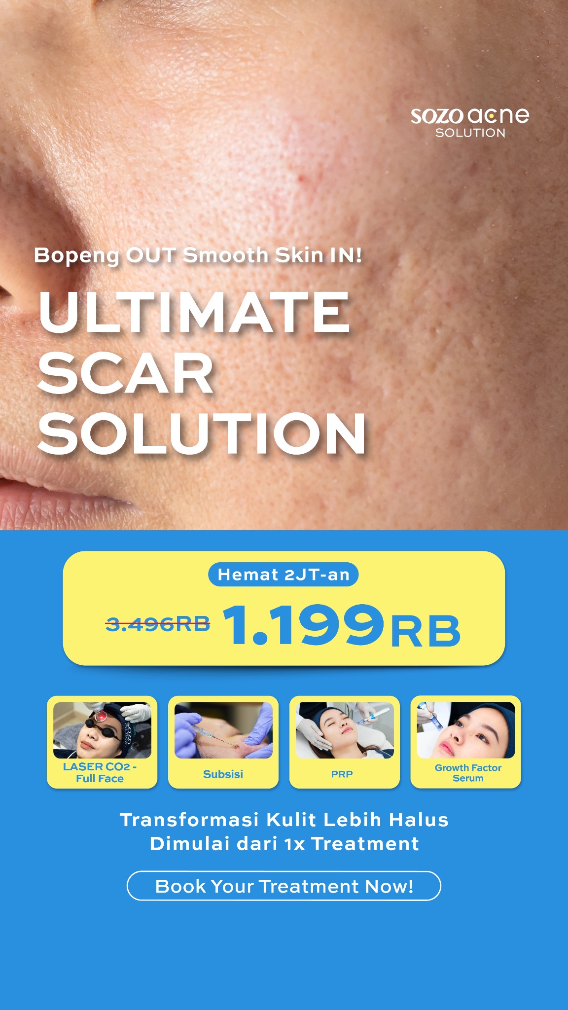 Sozo Acne Facebook ad