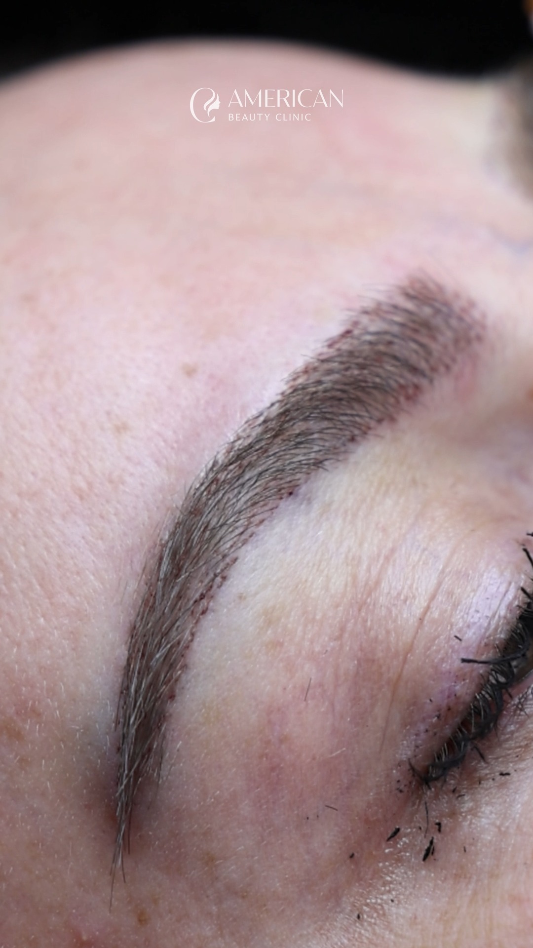 American Beauty Clinic Facebook ad: Vetullat që zgjasin tërë jetën