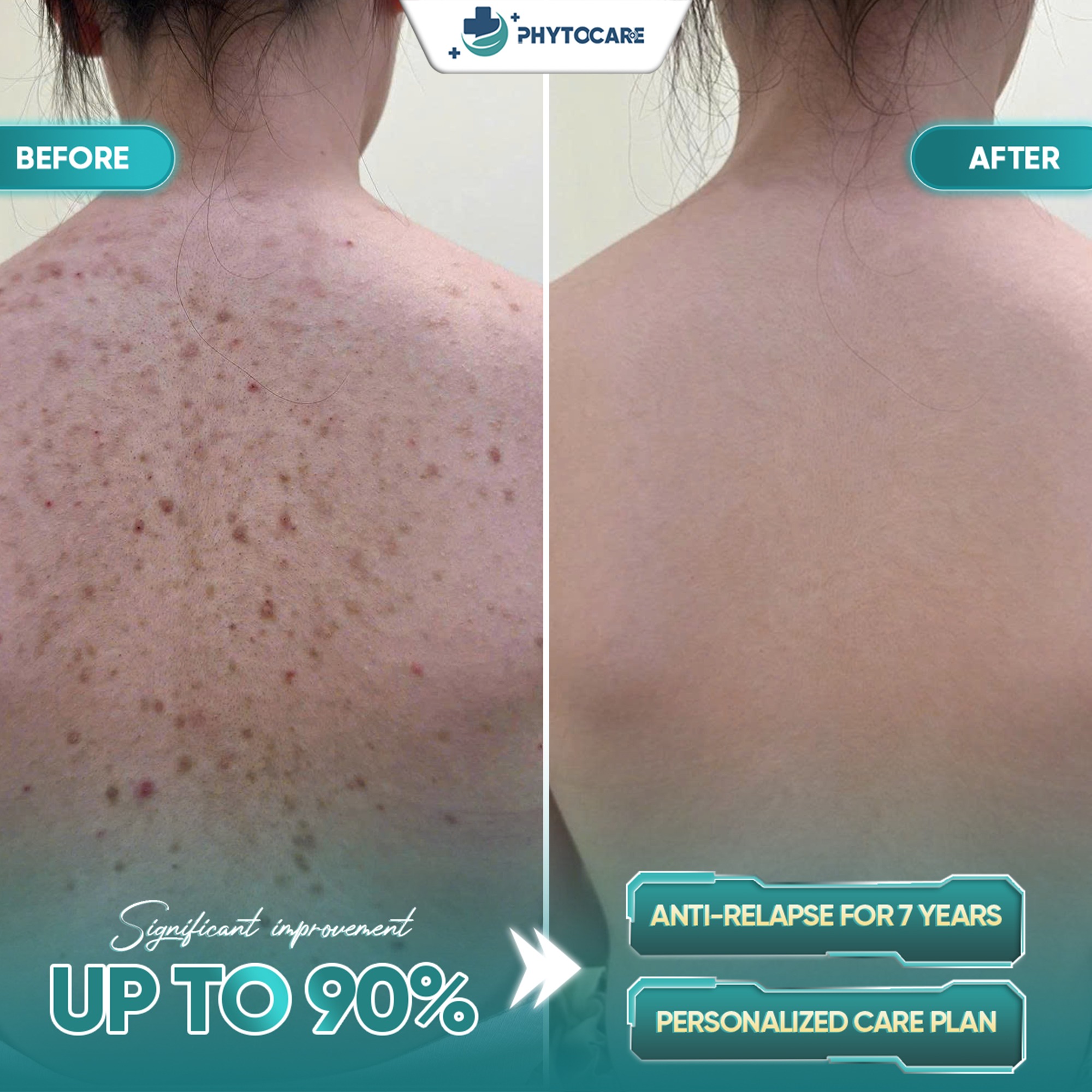 Cebu Phytocare Skin Clinic Facebook ad