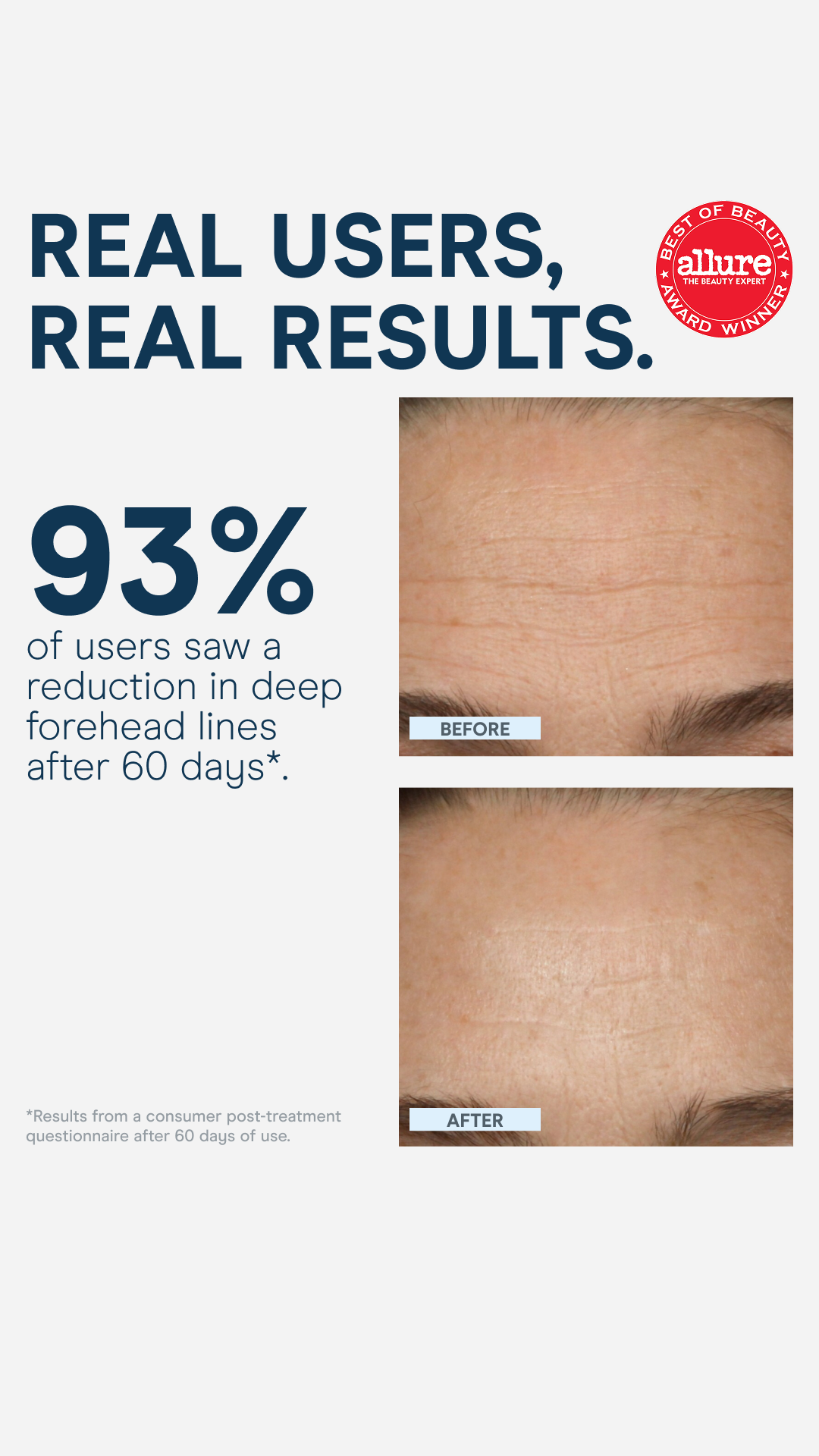 NuFACE Facebook ad