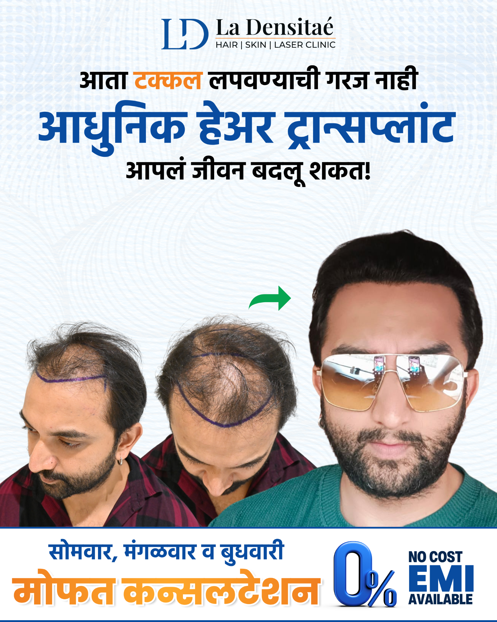La Densitae Hair Transplant Clinic Facebook ad