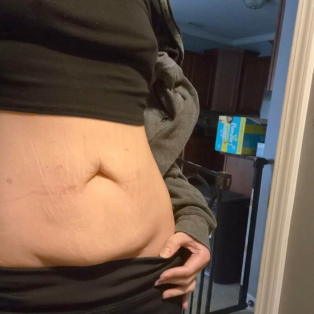Sandra Facebook ad: If your postpartum belly is still saggy read this!
