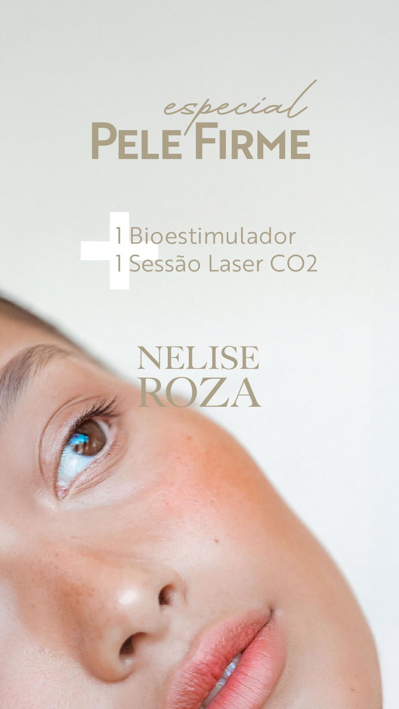 Spa Nelise Roza Facebook ad: Converse conosco