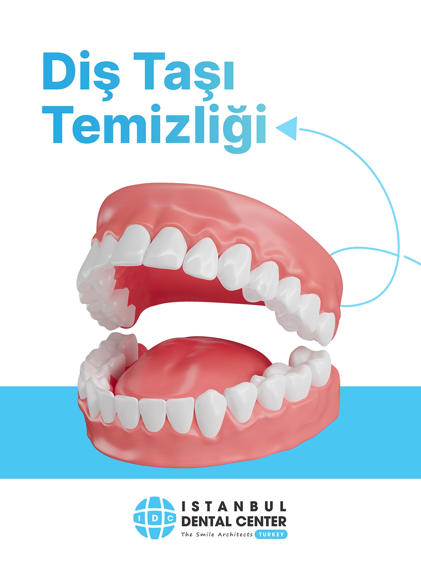 İstanbul Dental Center Türkiye Facebook ad: Diş taşı, diş eti problemlerinin en önemli nedenlerinden…