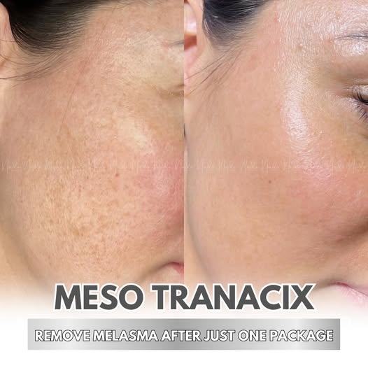 Dr.Nado Beauty Facebook ad: Dark Spots Stealing Your Glow?