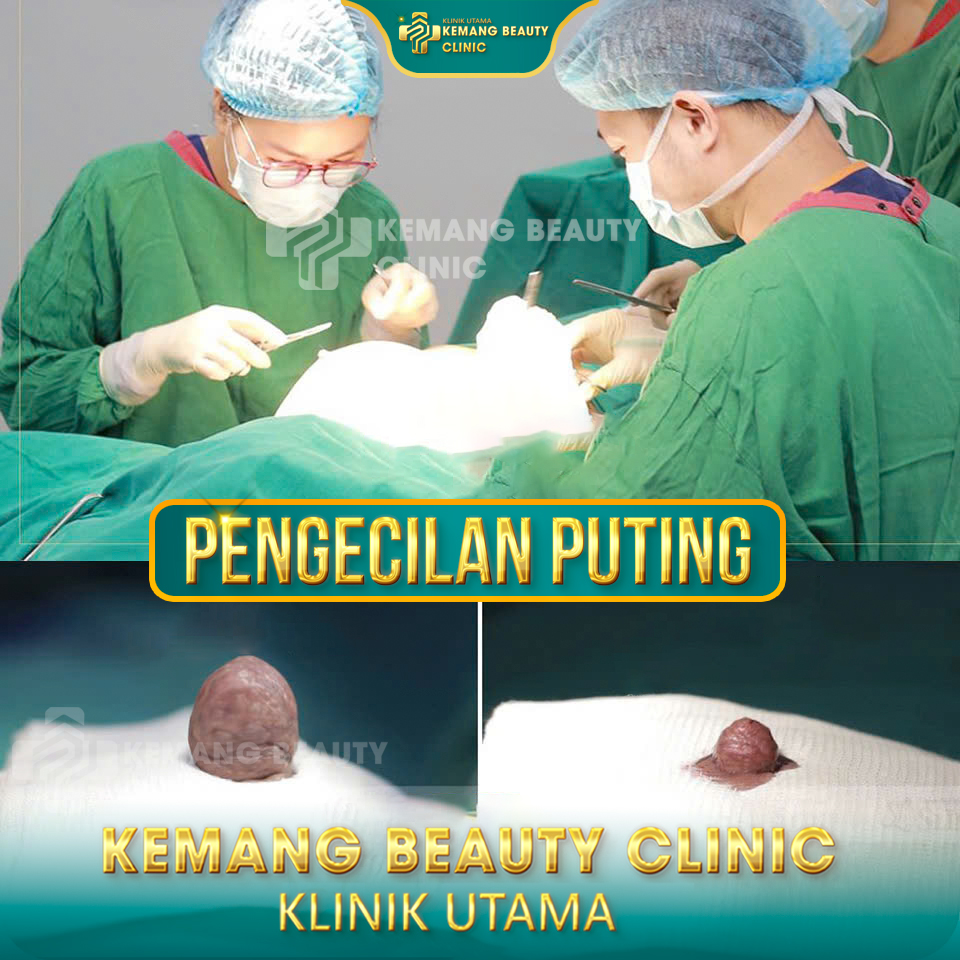 Kemang Beauty Clinic688 Facebook ad