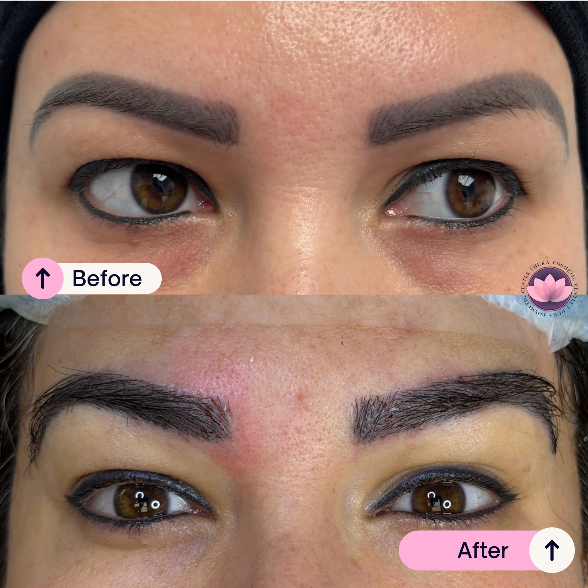 Huka Cosmetic Center Miami Facebook ad: Natural Brow Enhancement