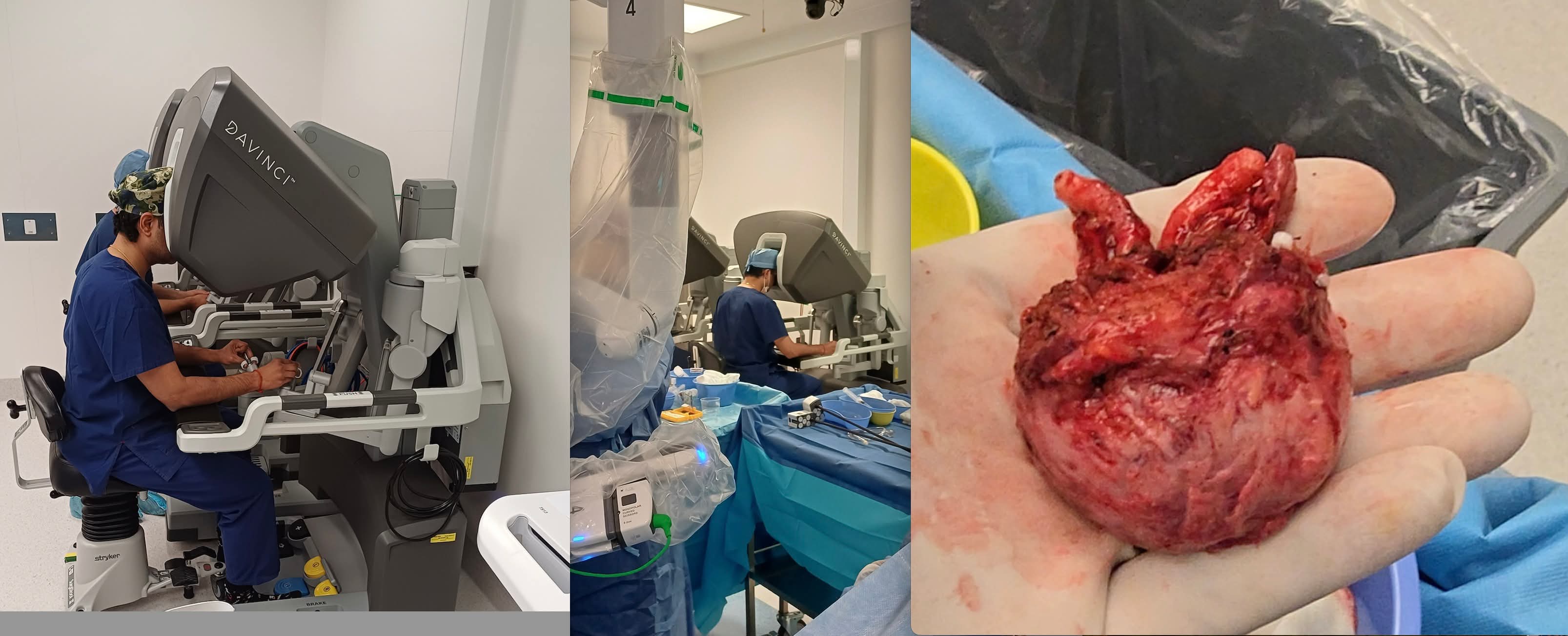 Dr. Arvind Jagwani Urologist Facebook ad: Urologist, Robotic Surgery, Minimally Invasive Surgeries…