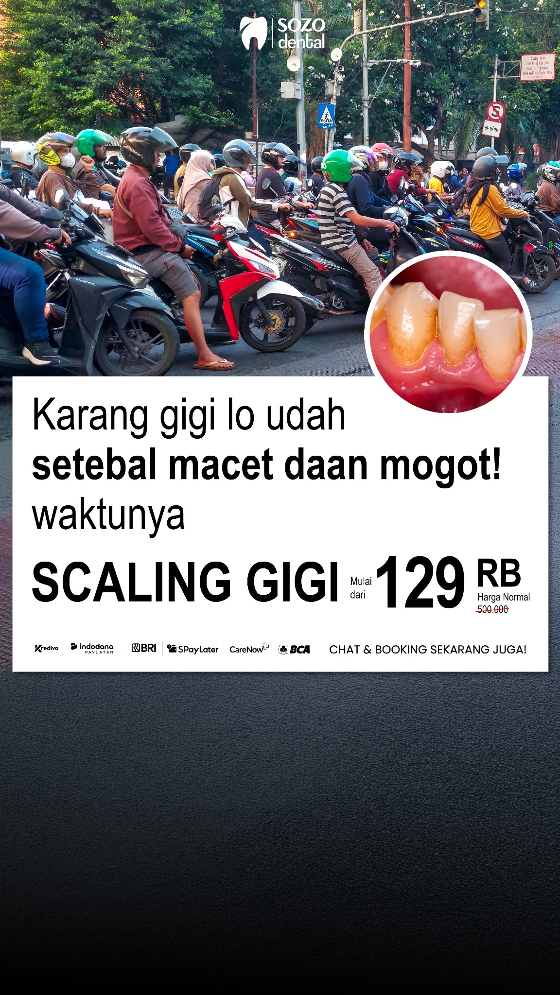 Sozo Dental Clinic Facebook ad: Basic Scaling 129 Ribu!
