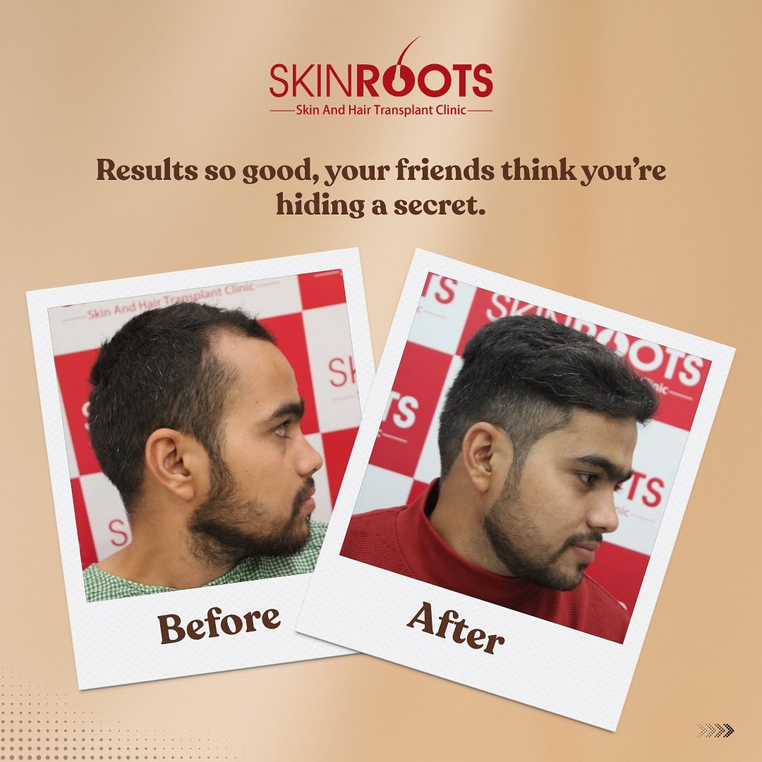 Skinroots clinic Facebook ad: Chat with us