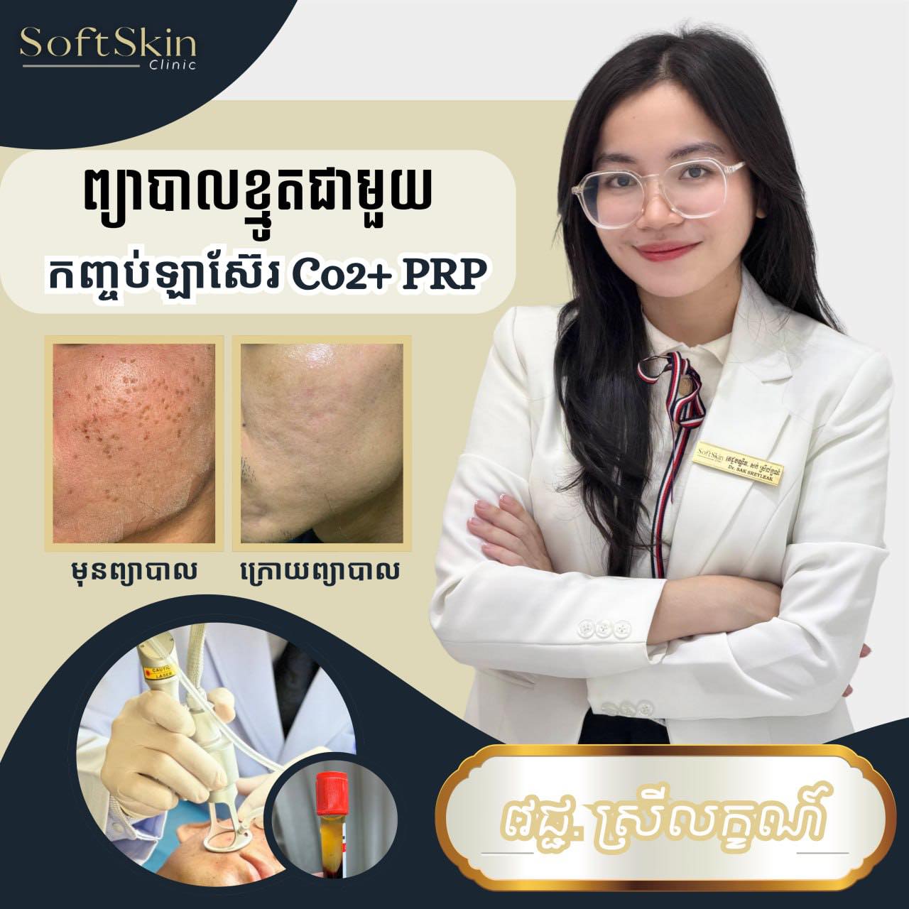 SoftSkin Clinic Facebook ad: សេវាកម្ម Laser Co2+PRP ជាវិធីសាស្ត្រព្យាបាលលើបញ្ហាស្នាមខ្មូ…