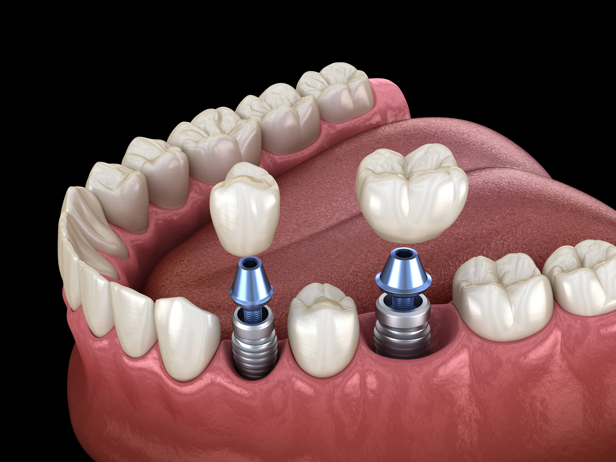 Bella Vida Dental Facebook ad: At Bella Vida Dental, we are dedicated to…