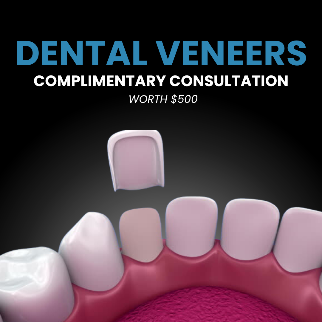 Hoppers Crossing Family Dentist Facebook ad: Free Dental Veneers Consult (Value $500)