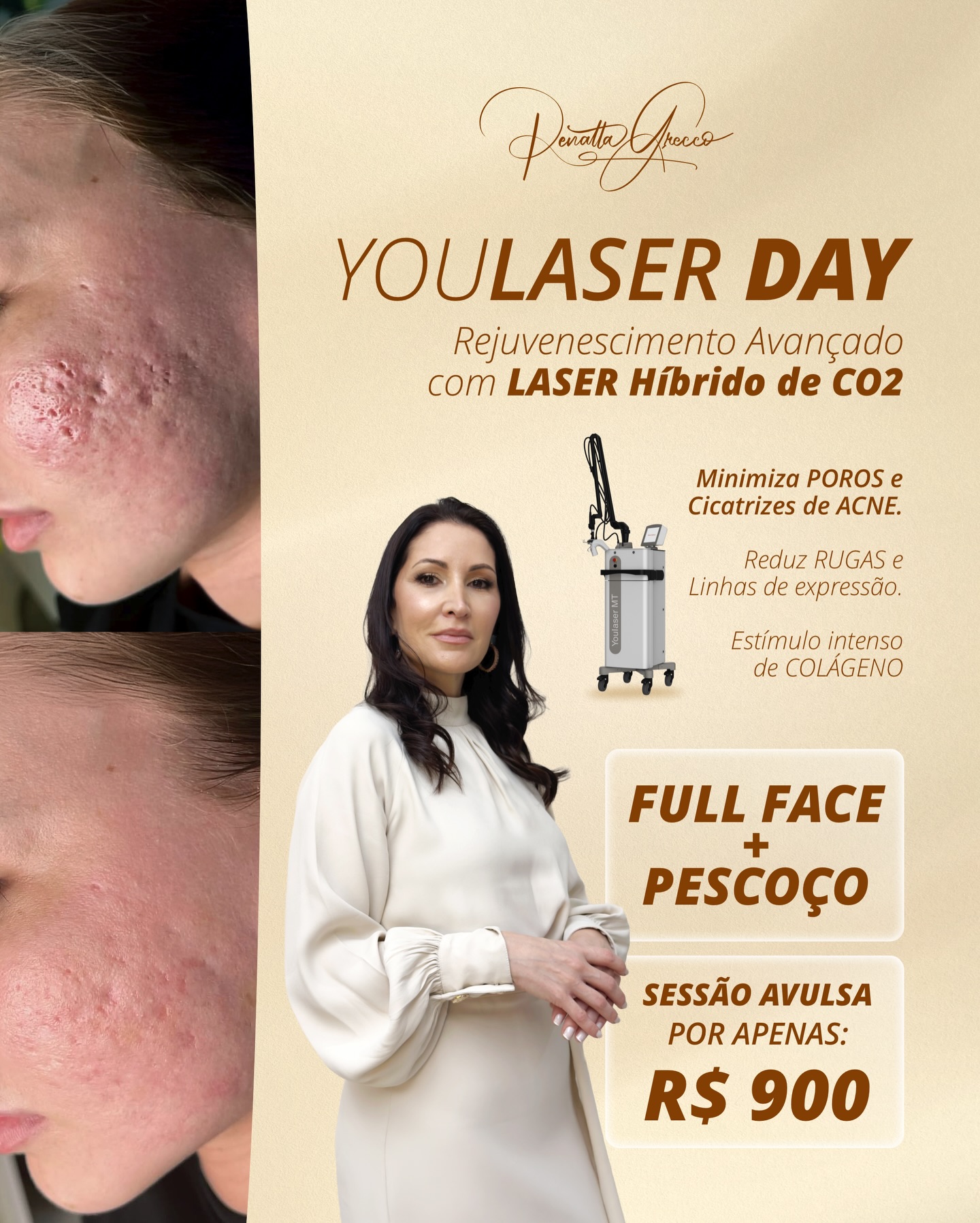 Dra Renatta Grecco Facebook ad: YOULASER DAY.