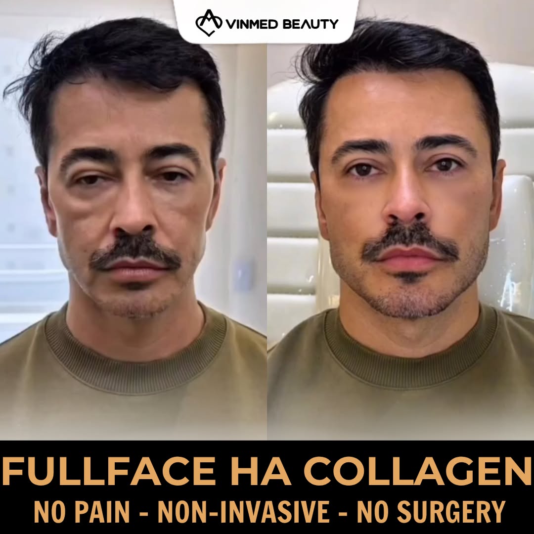 Vinmed International Aesthetic Institute - Dubai Branch Facebook ad