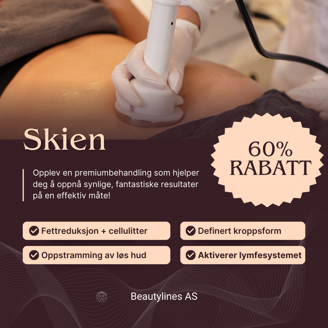 Beautylines Facebook ad: Akkurat nå for kun 990 kr (Ord. pris 2500 kr)