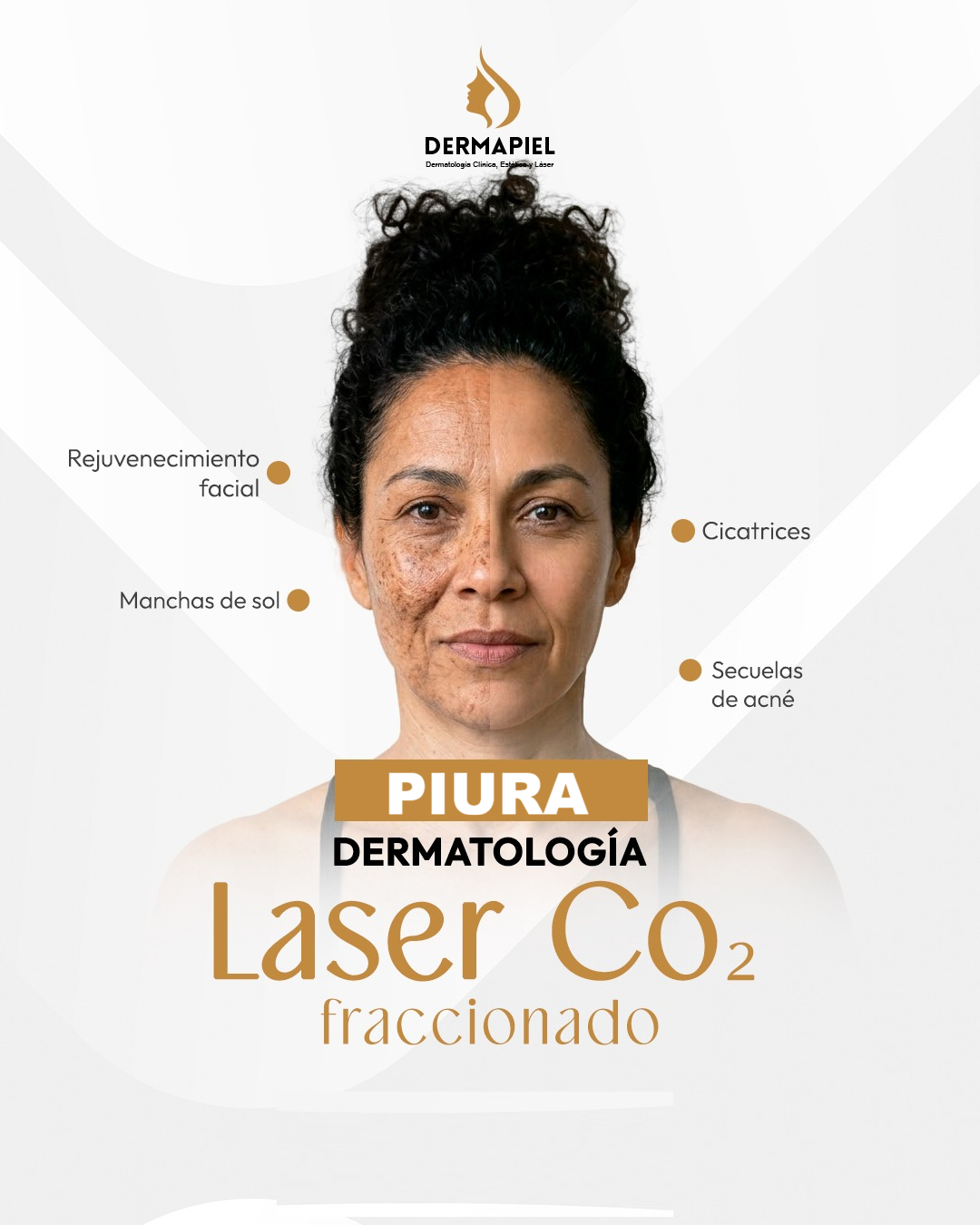 Dermapiel - Dermatología Clínica Estética y Laser  Facebook ad