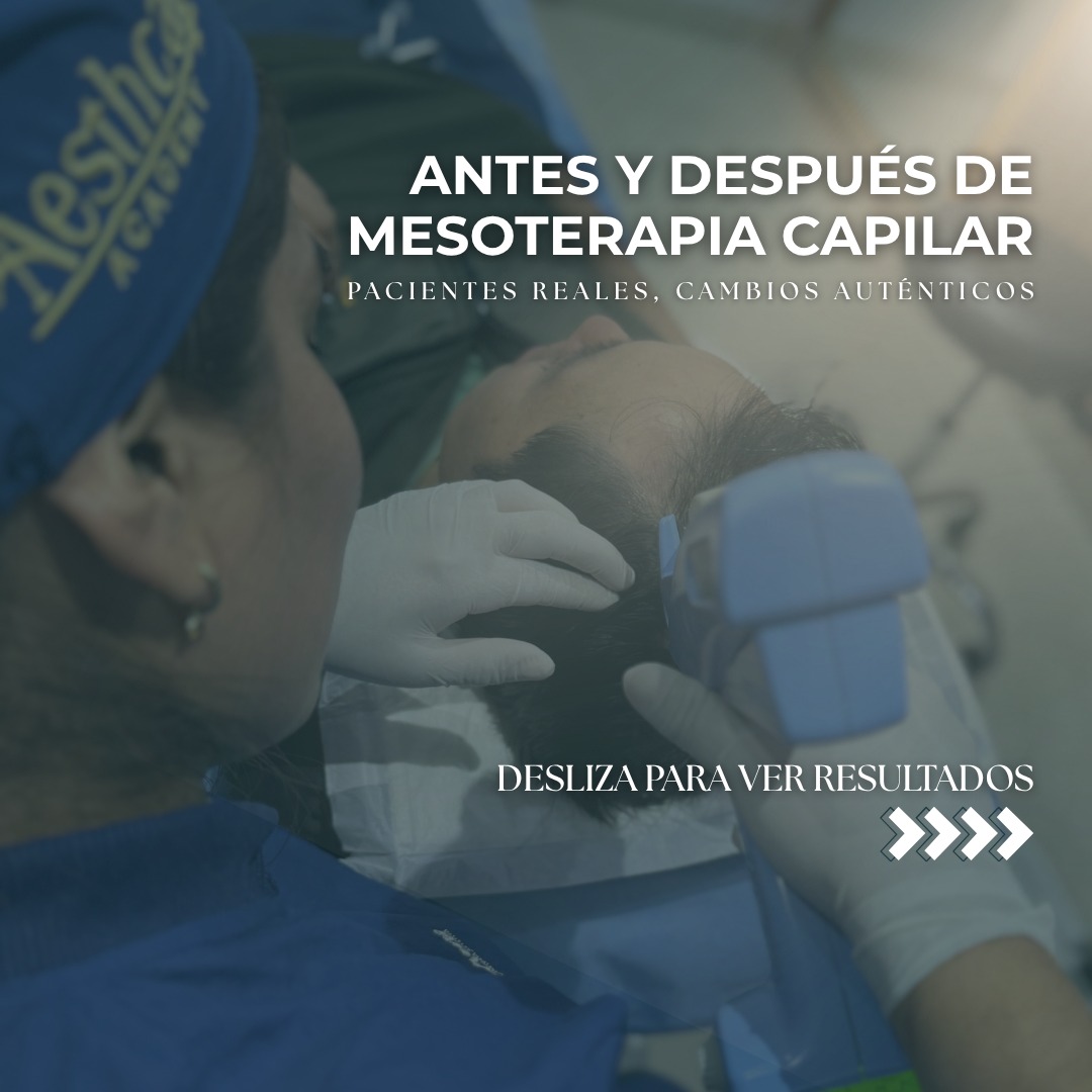 Dr. Esaud - Trasplante Capilar & Medicina Estética Facebook ad