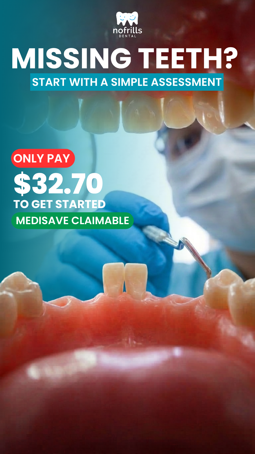NoFrills Dental Facebook ad: Medisave Claimable Dental Implants
