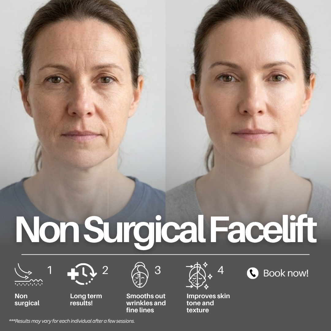 TS Hydration & Wellness Medical Center Facebook ad: Get the Non Surgical Facelift for ONLY $549!
