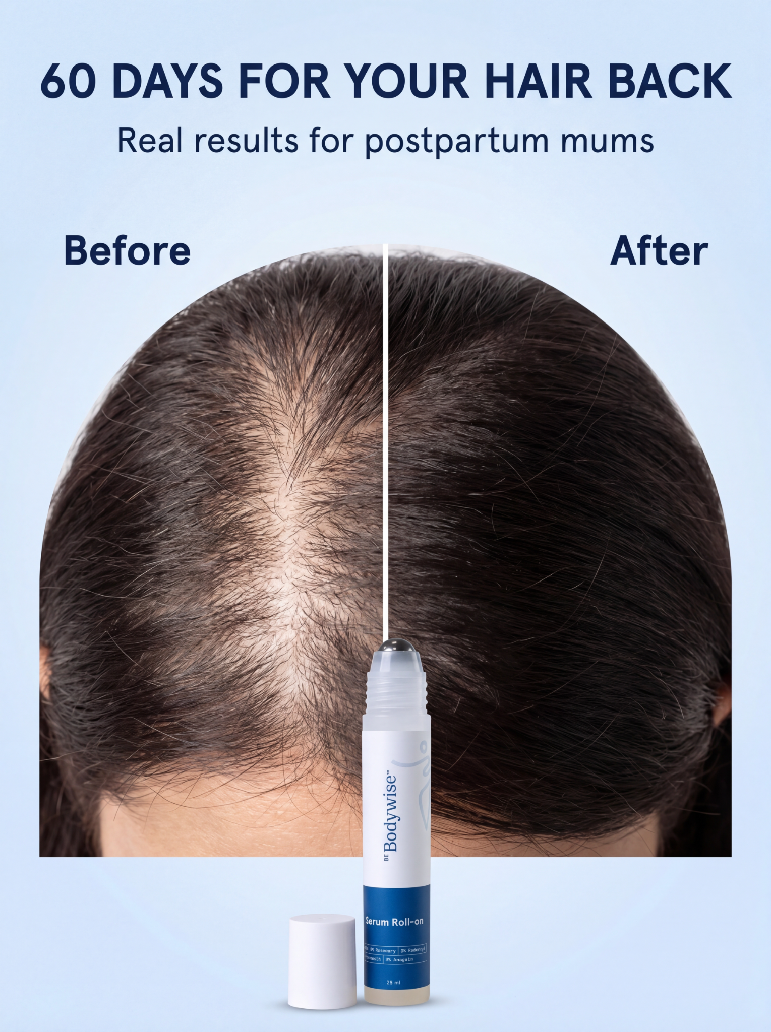Soothbliss. Facebook ad: For Postpartum Hair loss