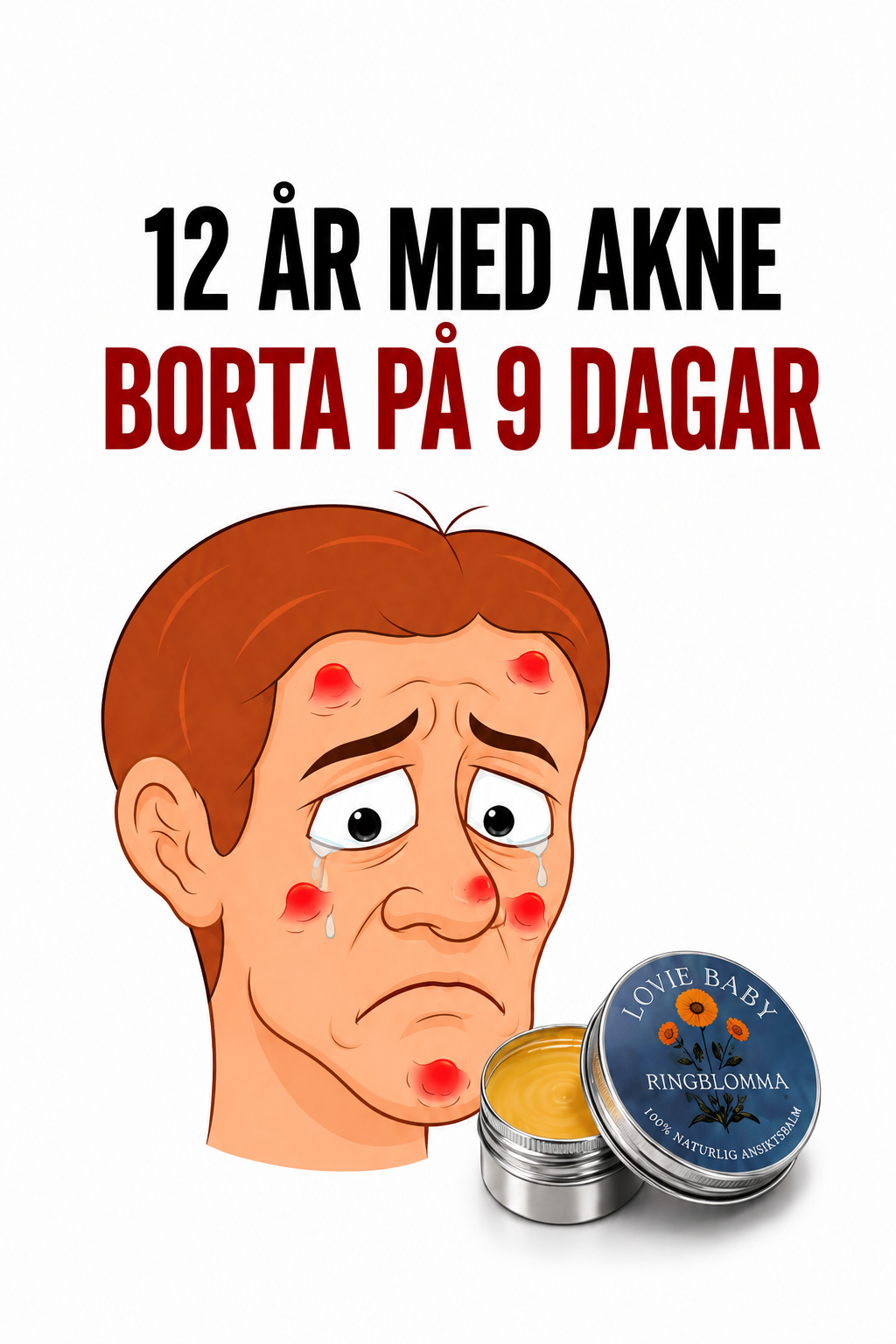 LovieBaby Facebook ad: Naturlig hudvård för akne