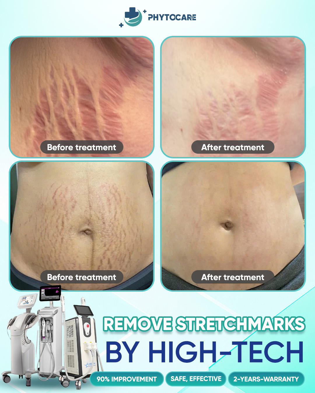 The Top1 scar treatment and skincare clinic in Makati Facebook ad: Psoriasis & Eczema Treatment, Up to 90% Effective