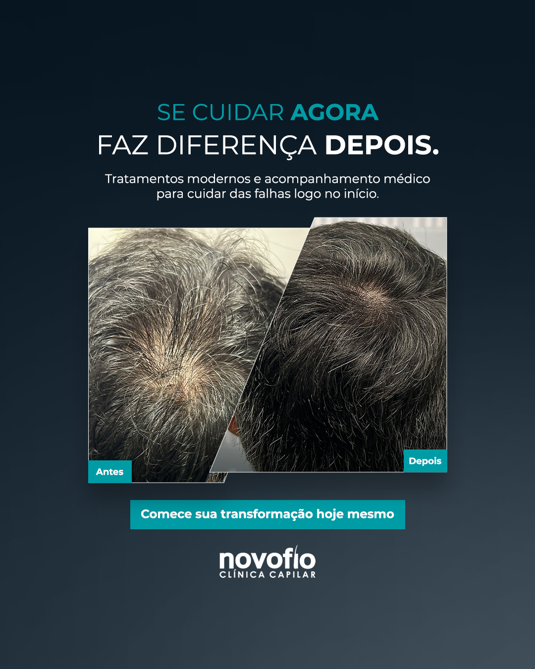 Novofio Jundiaí  Facebook ad