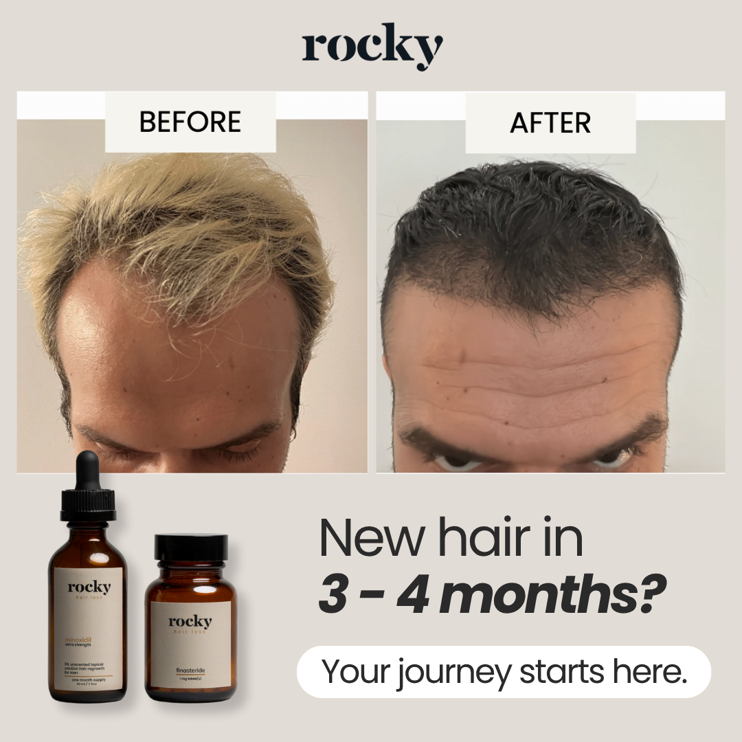 MyRocky Facebook ad