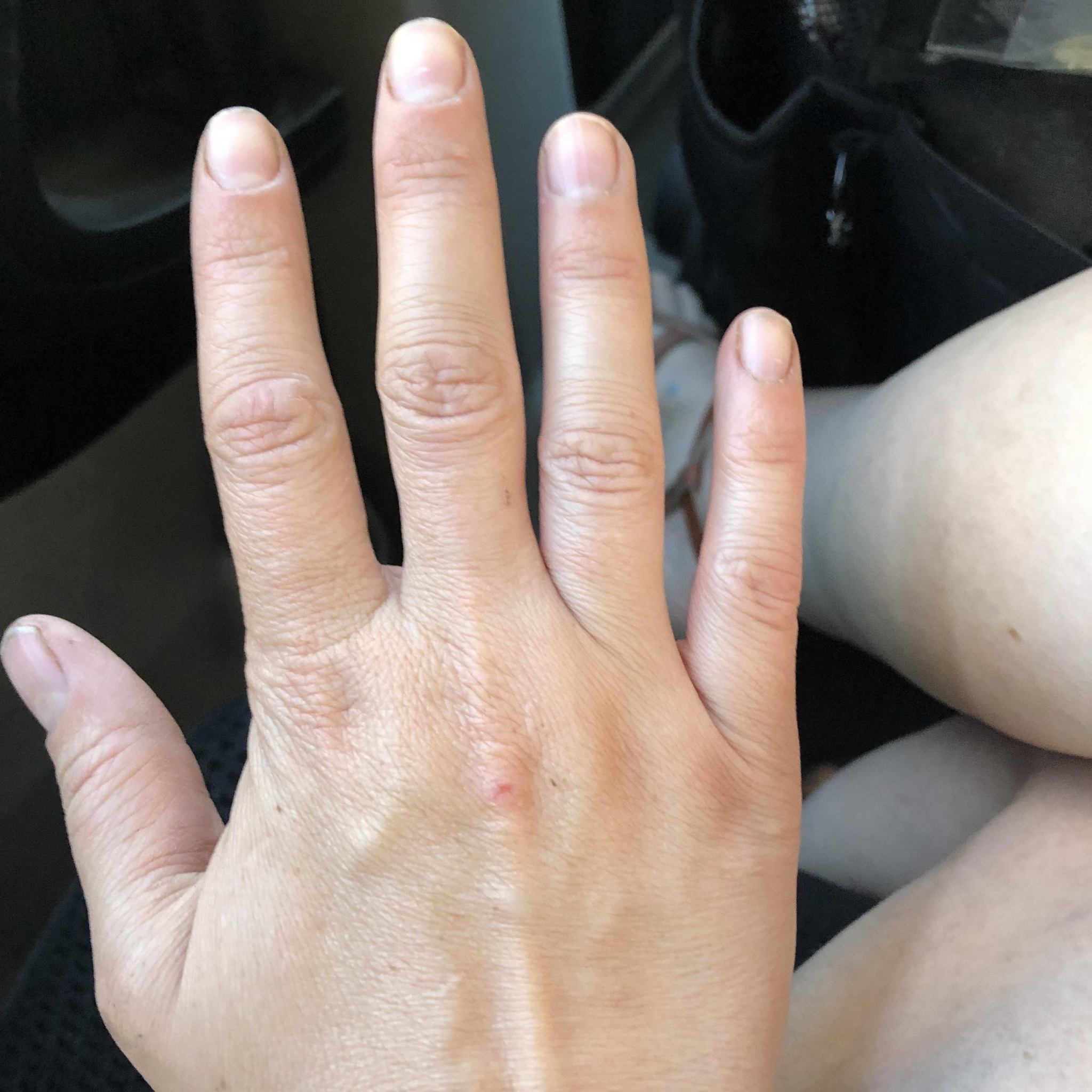 Deborah Rustad Facebook ad: Best mineral for rheumatoid arthritis pain?