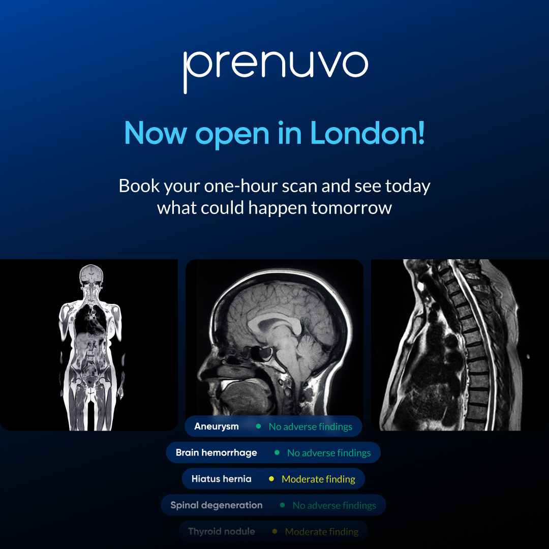Prenuvo Facebook ad