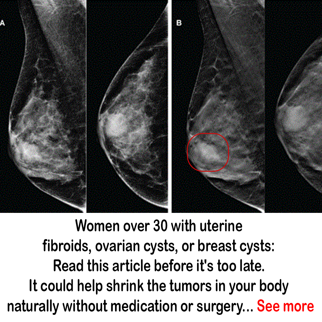 Teacher maria Facebook ad: Methods for shrinking tumors at home