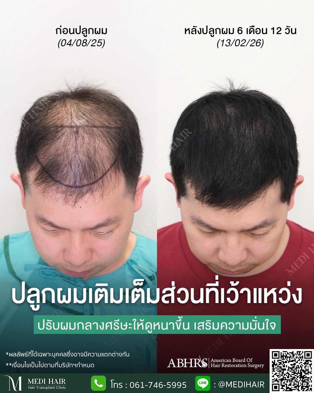 MEDI HAIR Facebook ad