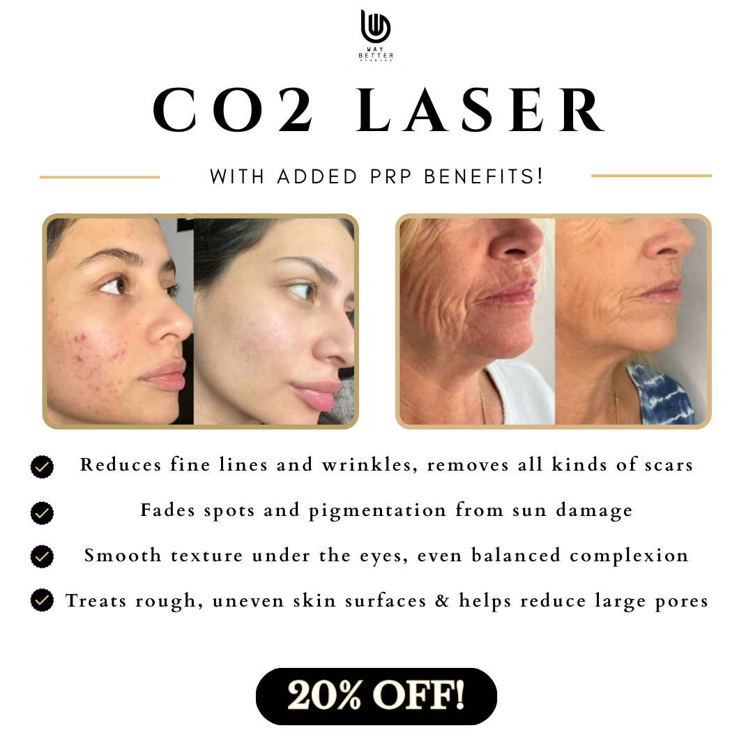 Way Better Laser Clinic Facebook ad: 20% OFF Transform Your Skin with CO2 Laser + PRP