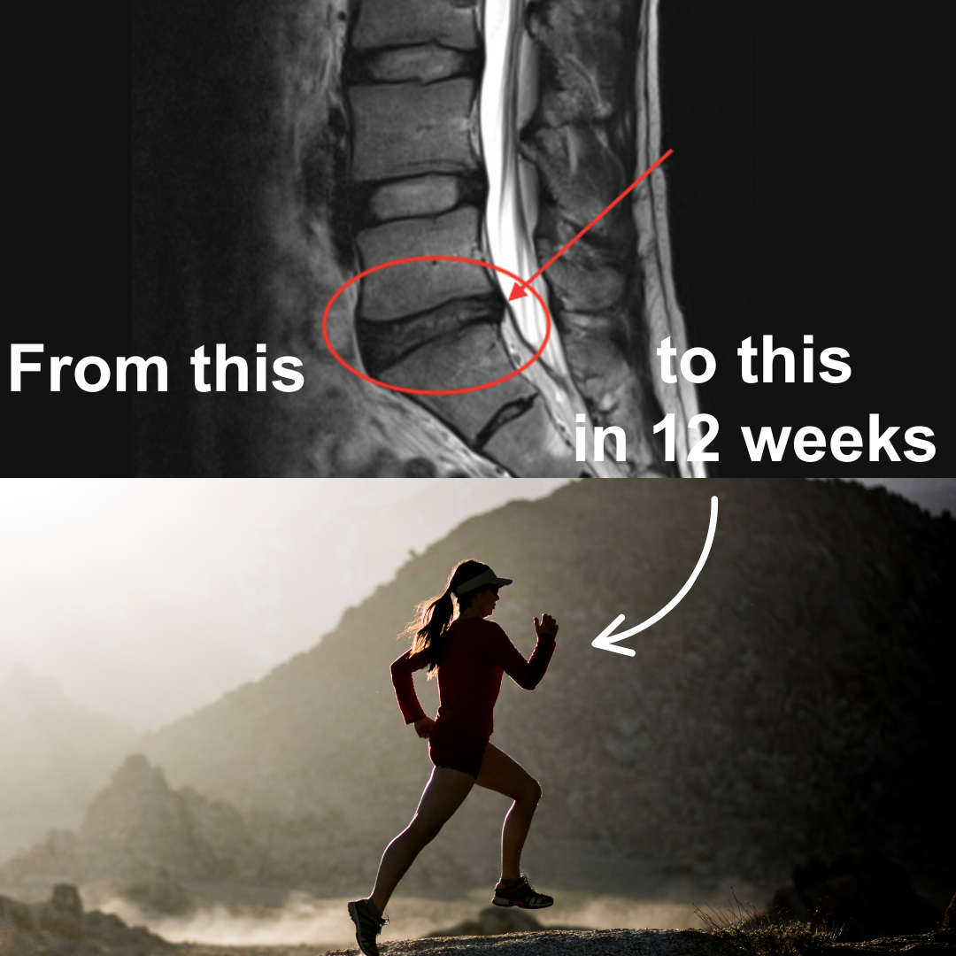 Postureletics - Back Pain Relief Facebook ad: Discover How to Relieve Back Pain, Take the Test