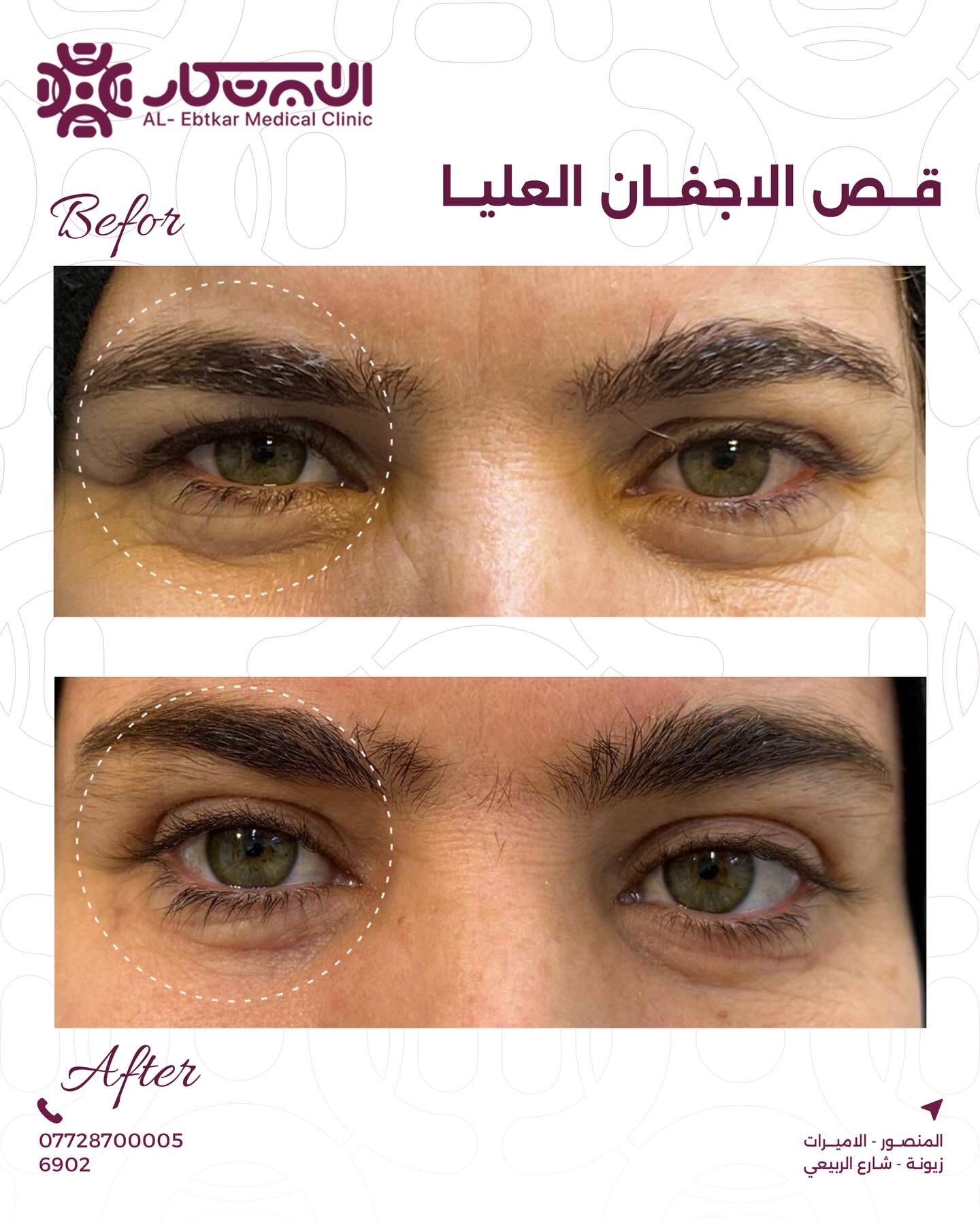 عيادة الابتكار Facebook ad