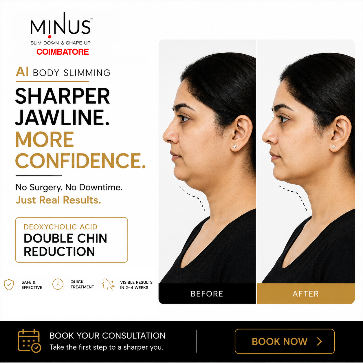 Minus Slimming Clinic Coimbatore Facebook ad from Jun 12, 2026