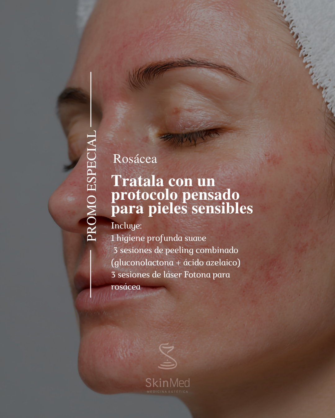 Skin Med Facebook ad: ¿El enrojecimiento, la sensibilidad o las manchas ya…